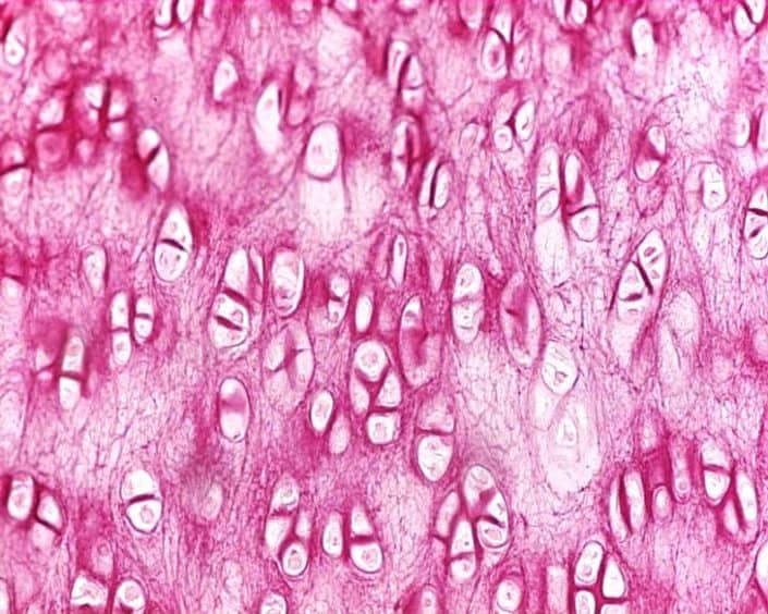 cartilagine